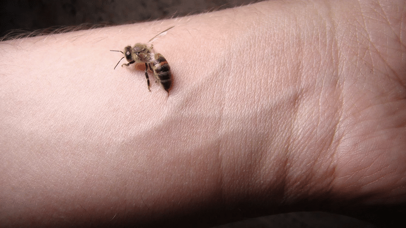 A bee stinger is visible penetrating this person's wrist; bee stings frequently have stingers left in them
