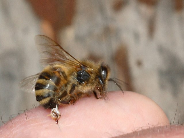 A honey bee stinging a human hand, injecting bee venom into the skin